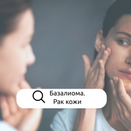 Базалиома. Рак кожи Базалиома. Рак кожи