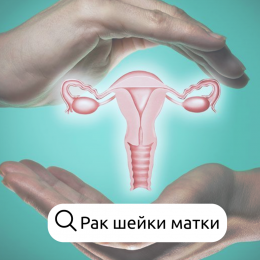 Что важно знать о раке шейки матки Что важно знать о раке шейки матки