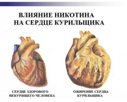 Алкоголь и курение поражают сердце Алкоголь и курение поражают сердце