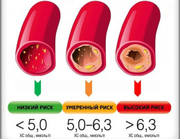 Ишемическая болезнь сердца Ишемическая болезнь сердца