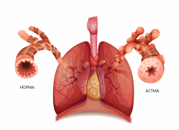 Чем опасна бронхиальная астма?